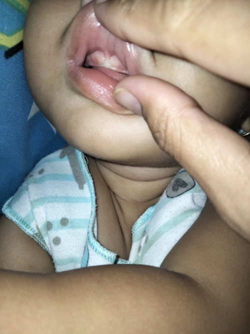 tumbuh gigi