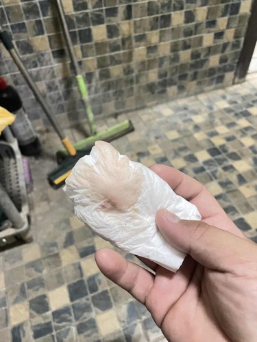 40 wพอดียังไม่ถึงกำหนดผ่า