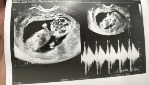 Hi ask ko lang po kung may nub theory expert po dito? Ano po sa tingin nyo gender ni bb ko hehe