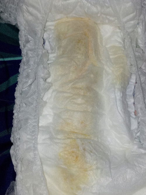 Pipis bayi berwarna kuning pekat