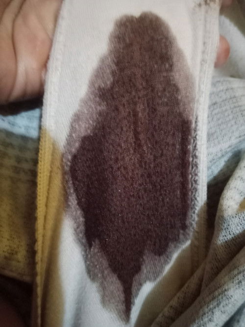 Keluar flek coklat kehitam-hitaman