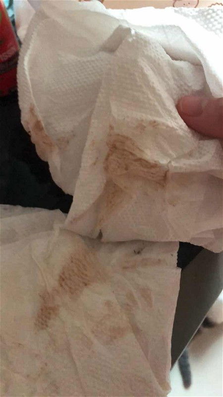 สงสัยอาการใกล้คลอด