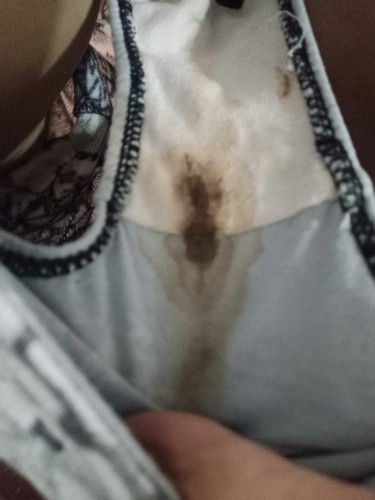 Black or brown spotting ? Ano ibig sabihin?