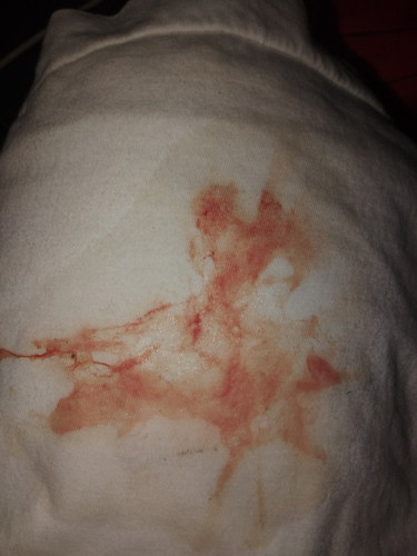 สอบถามคะถ้าแบบนี้ใช่มูกเลือดไหมคะ