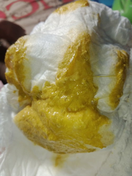 ถ่ายเป็นมูก