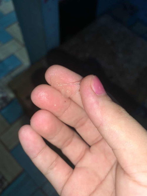 Keluar lendiri bening