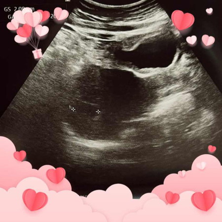 Baby No.2 🥰❤️👶🏻