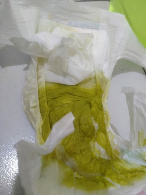 Bagaimana cara mengatasi diare untuk bayi 3bulan