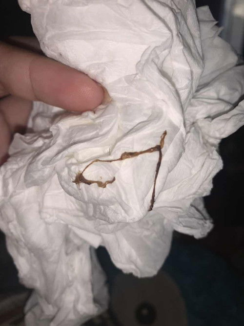 hamil 7w 5h ngeflek dari kmarin