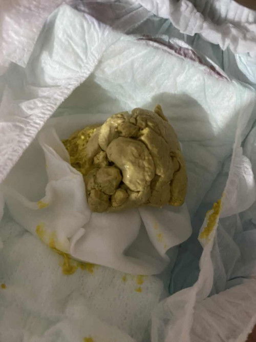 Có bé nhà m nào đi phân như này k ạ