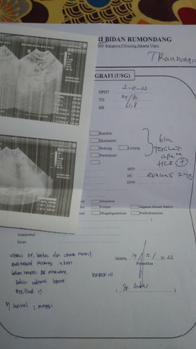 Hasil USG 6 week TPI blm kliatan kantong janin nya