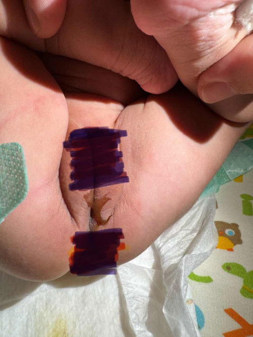 G6pd** สอบถามอาการ g6pd