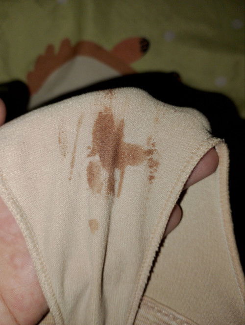 Currently 39weeks and 2days
Punta na po ba ako hospital? Panay sakit na din ng puson pero nawawala