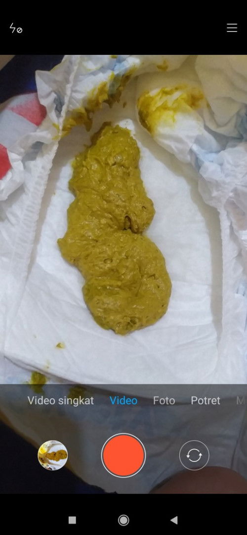 Pup bayi 1 bulan 25 hari konsumsi sufor