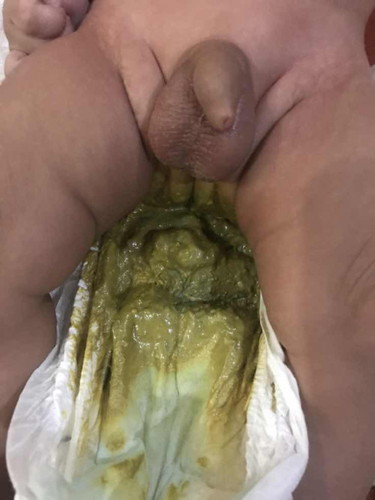 najis bayi hijau