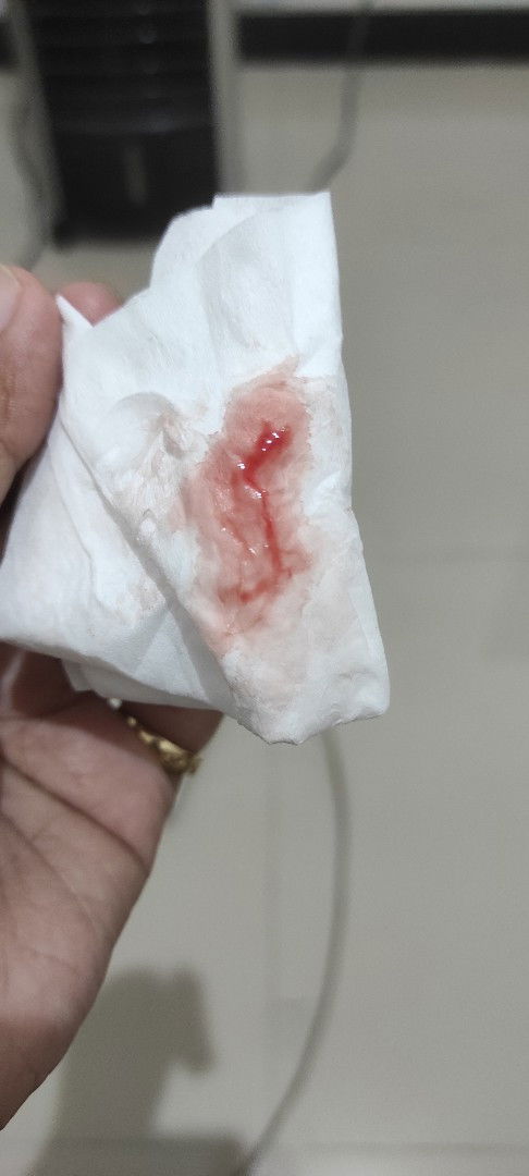 Keluar darah tapi perut ngga nyeri