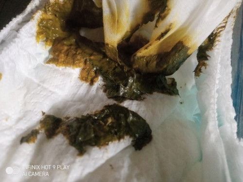 BAB bayi ASI mix SUFOR