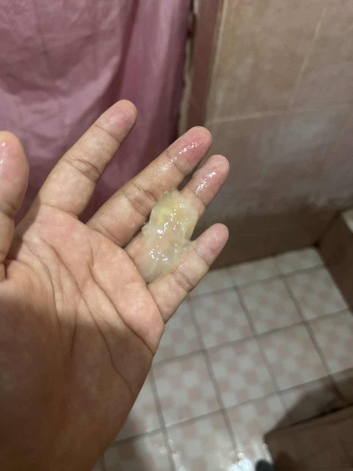 KELUAR GUMPALAN