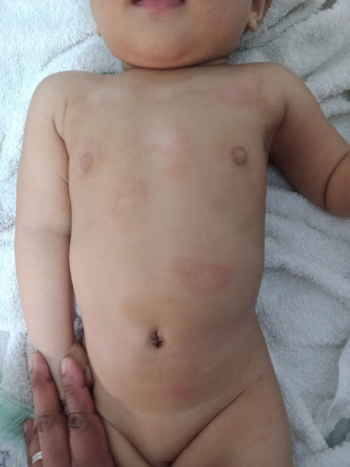 Ano po kaya itonglumitaw sa 10month old baby ko?