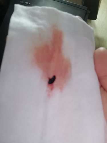 Delikado po ba ito 9weeks preggy po ako