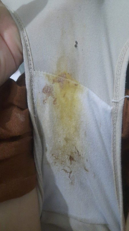 Muncul flek setelah cek panggul