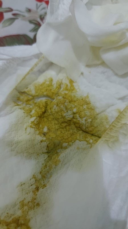 Pup berkali kali dan nyusu berkurang