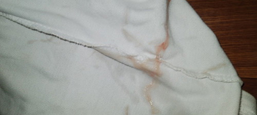 discharge dugo po ba or brown? lang