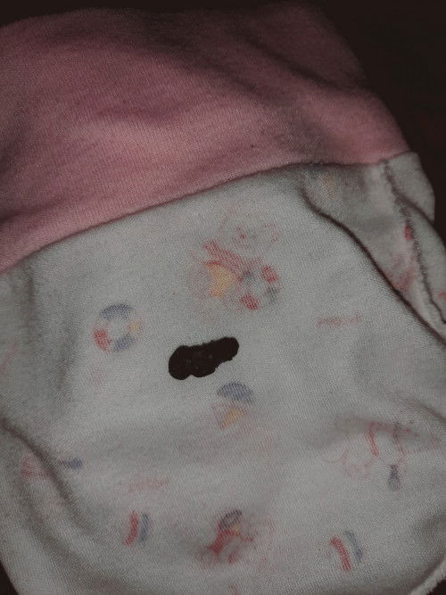 สะดือหลุด.