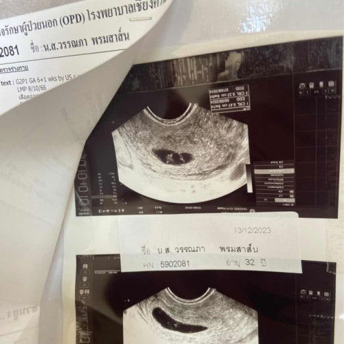 เลือดออกตอนตั้งครรภ์น้องตอน8สัปดาห์น้องยังอยู่ไหม