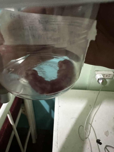 NAG KA APPENDIX PO ANG KAPATID KO π