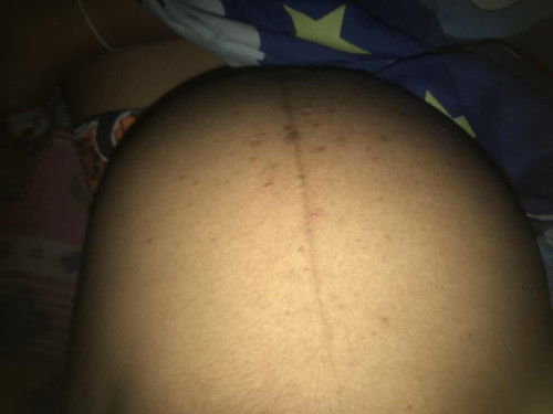 ท้องแข็งแบบนี้ควรไปพบแพทย์ไหม