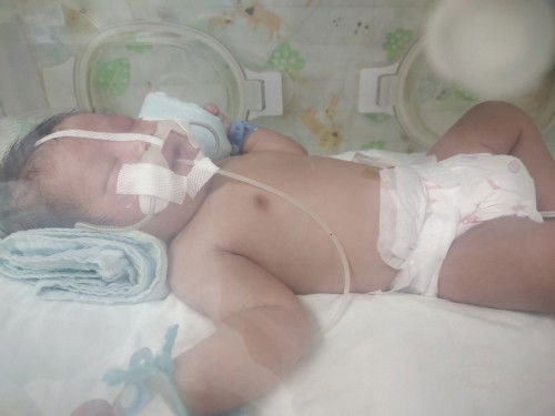 น้องหายใจเร็ว