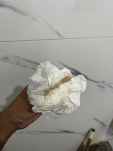 AMNIOTIC FLUID or MUCUS PLUG