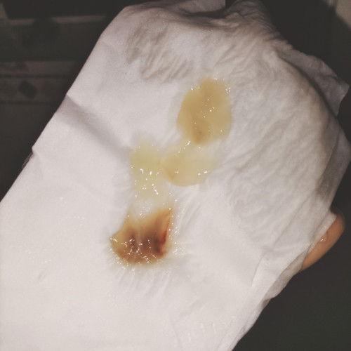 Các mom chỉ e với