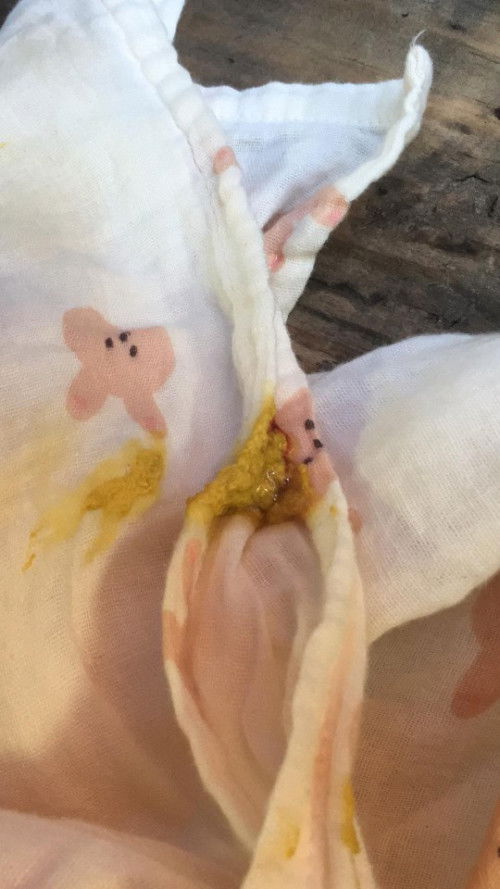 สีอึของน้องวัย 1เดือน 24วัน