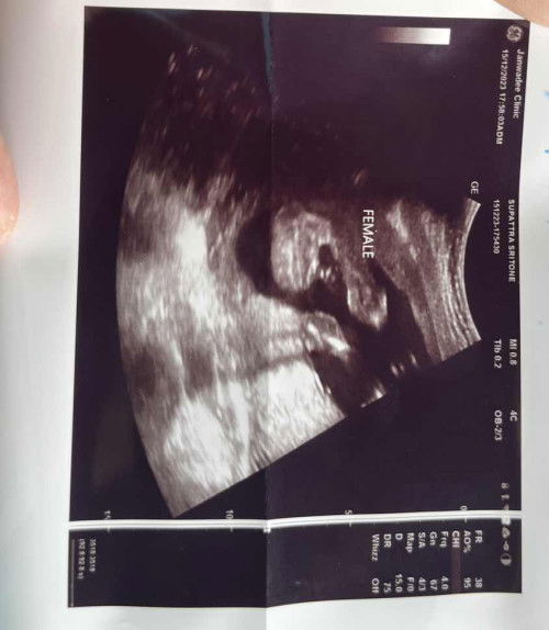 อัตราซาวด์เพศลูก