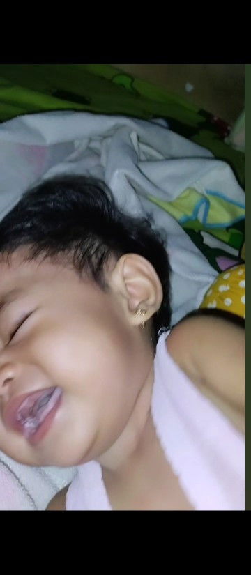 Muncul putih" di mulut bayi 8 bulan