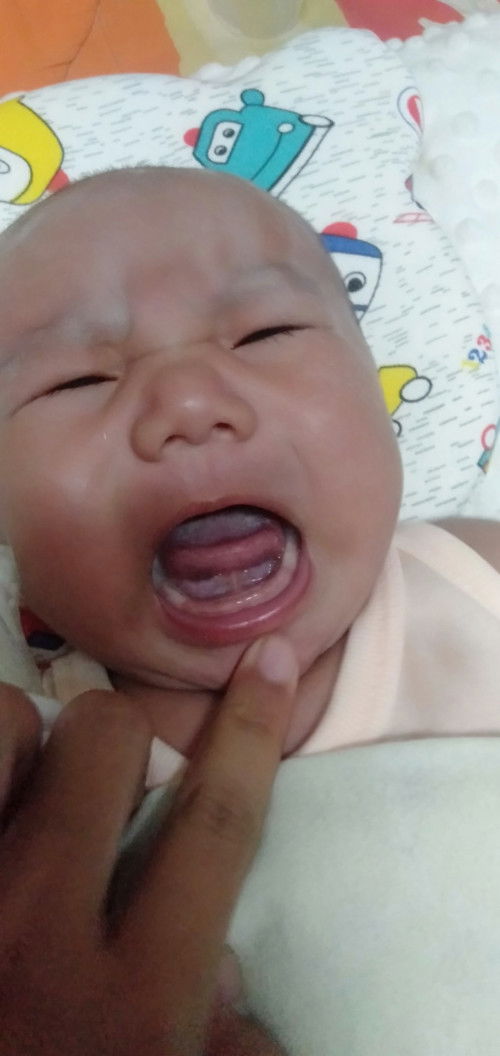 แบบนี้น้องเป็นพังผืดรึป่าวคะ