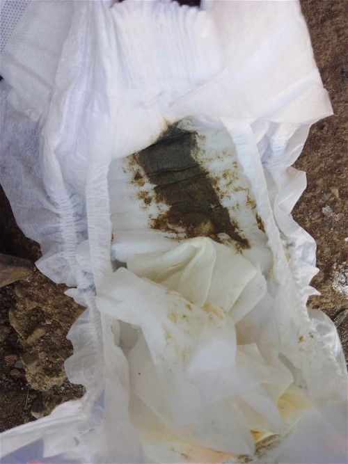 Dark color poop 6 months old baby