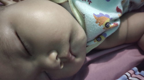 Awal mpasi anak, ini alergi kah?