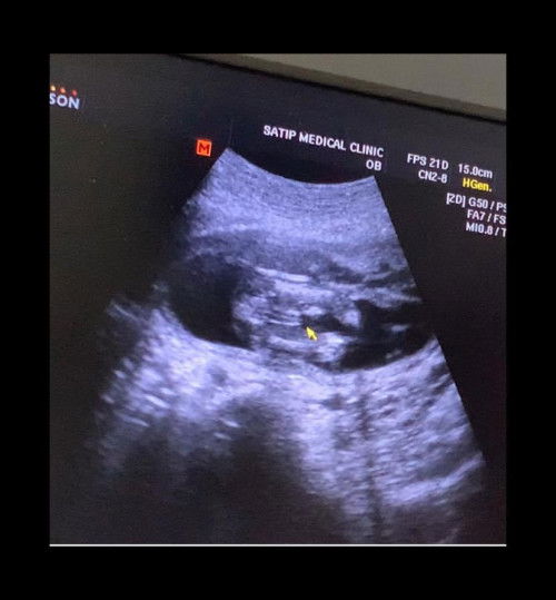 ลุงหมอบอกว่าน้องเป็นผู้ชายค่ะ