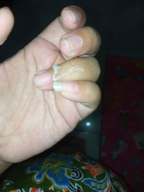 UK 38w3d keluar lendir