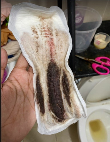 black blood