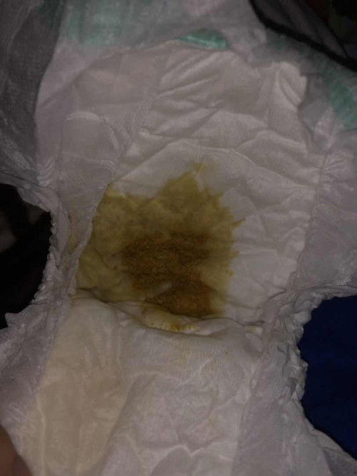 ขอสอบถามหน่อยค่ะแบบนี้ปกติมั้ยคะ