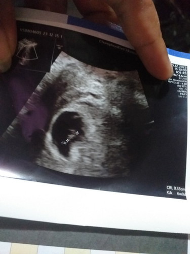 อยากรู้ว่าเด็กในท้องมีตัวแค่ 3 ซม มันกี่เดือนคะ แล้วเป็นอันตรายอะไรไหม