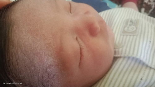 Dahi bayi bersisik putih