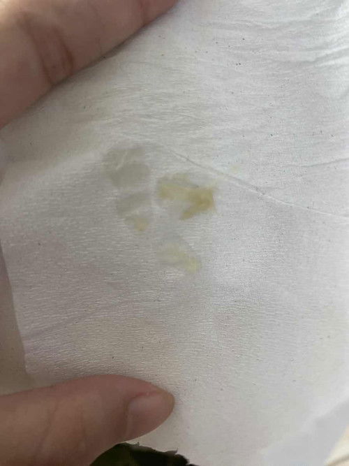 ท้อง 38w มีมูกสีเขียวข้นๆออกมา