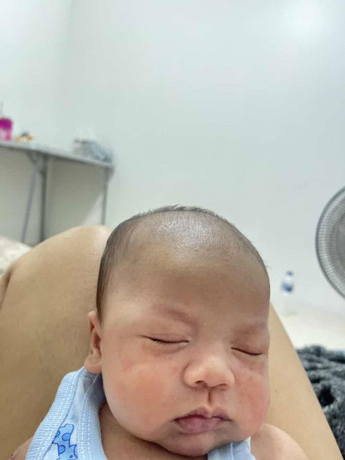 ลูกหัวเบี้ยว หัวไม่เท่ากัน ข้างนึงแบข้างนึงปกติ