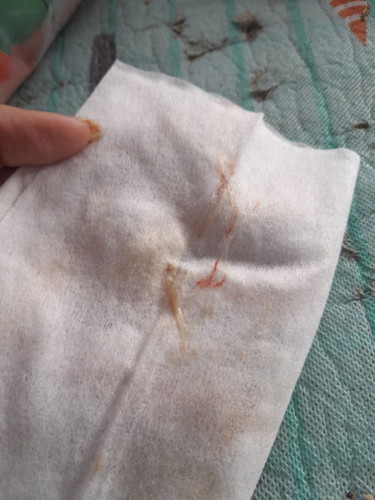 กลุ้มใจมากเลยค่ะ