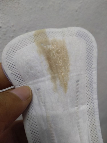 Dah 5 hari keluar mcm ni. Period lewat dh 23 hari, upt negatif. Kerap sakit pinggang dan senak perut